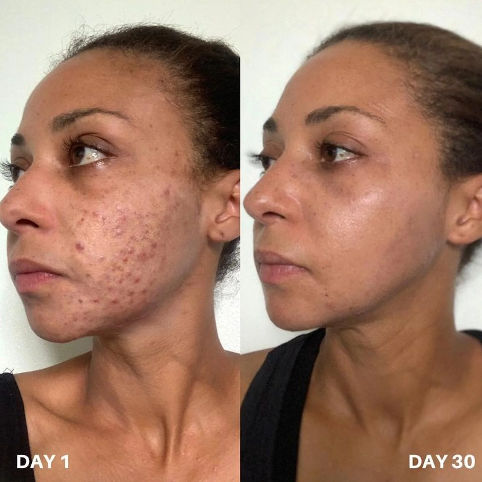 Clinisoothe+ | Skin Purifier 100ml - Image 3