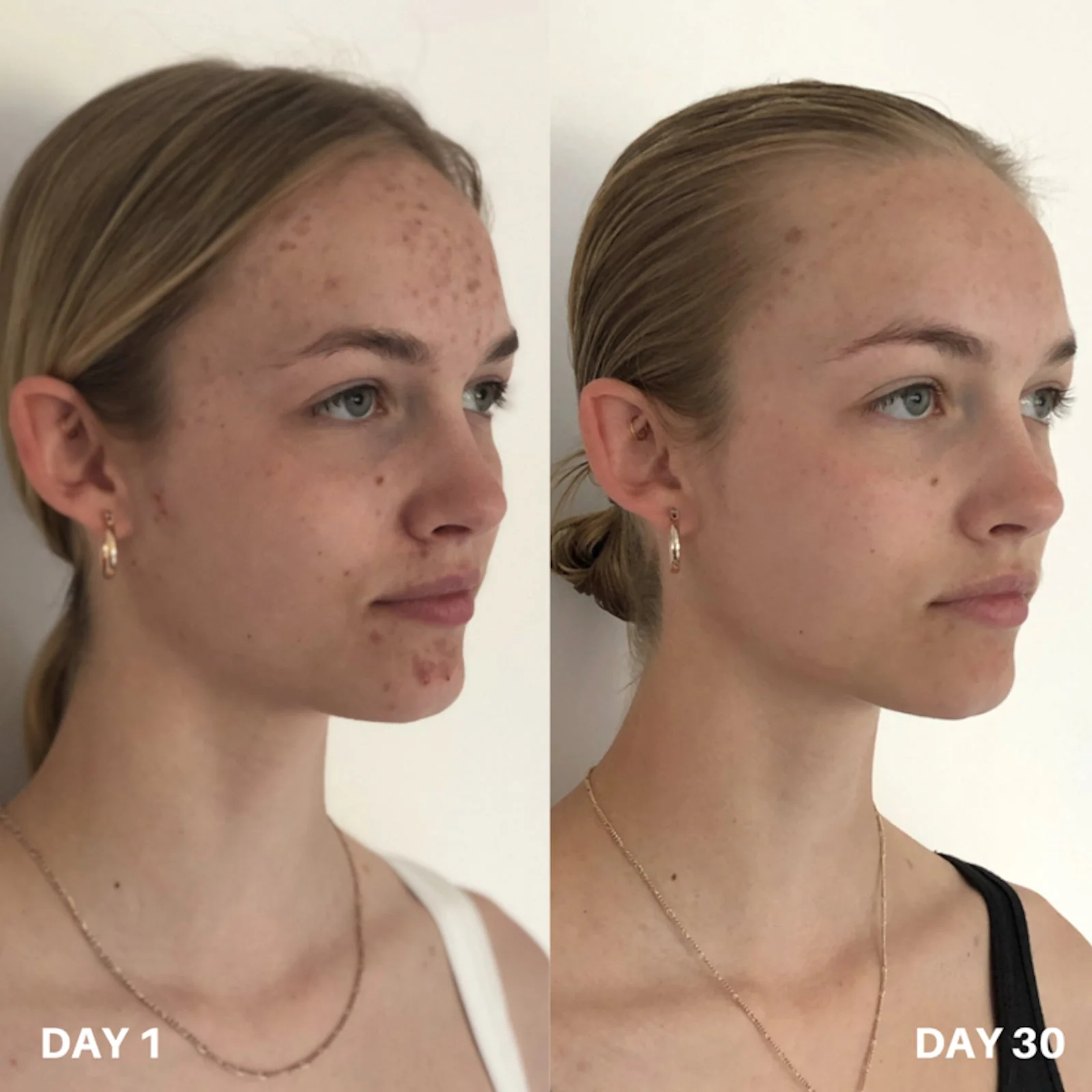 Clinisoothe+ | Skin Purifier 100ml - Image 4