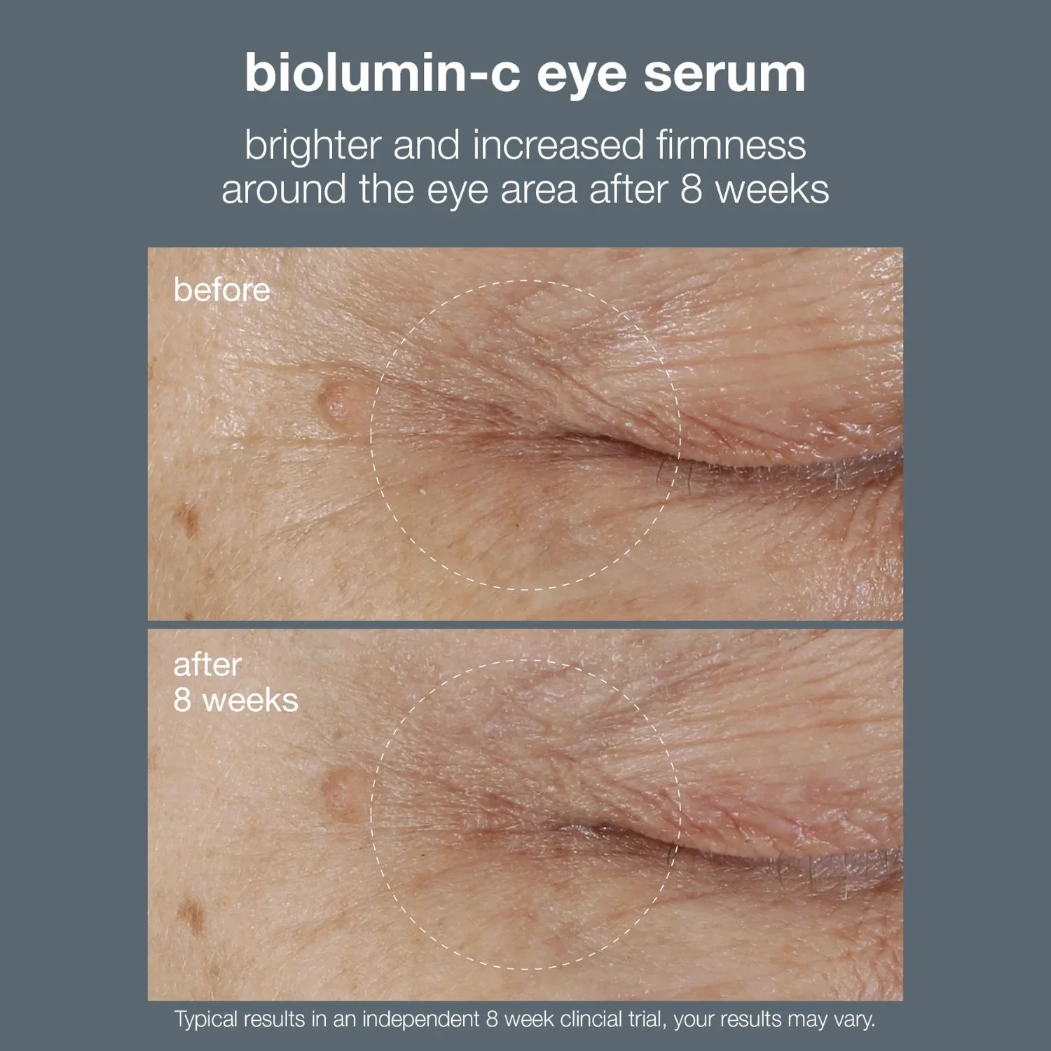 Dermalogica | BioLumin-C Eye Serum 15ml - Image 3