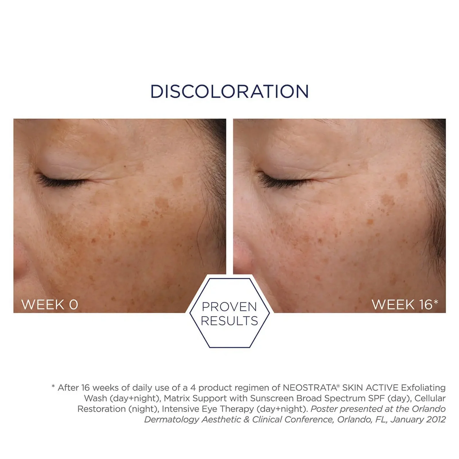 Neostrata | Repair Exfoliating Wash 125ml - Image 4