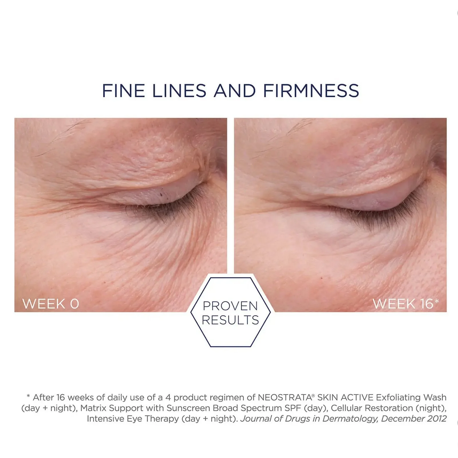 Neostrata | Repair Matrix Support SPF30 50g - Image 3