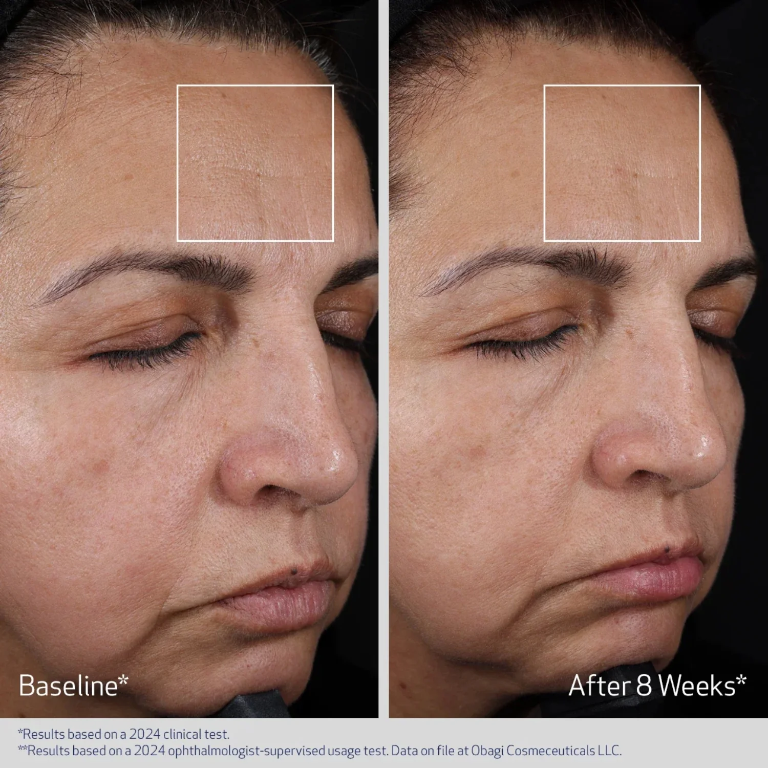 Obagi | ELASTIderm Advanced Filler Concentrate 20ml - Image 3