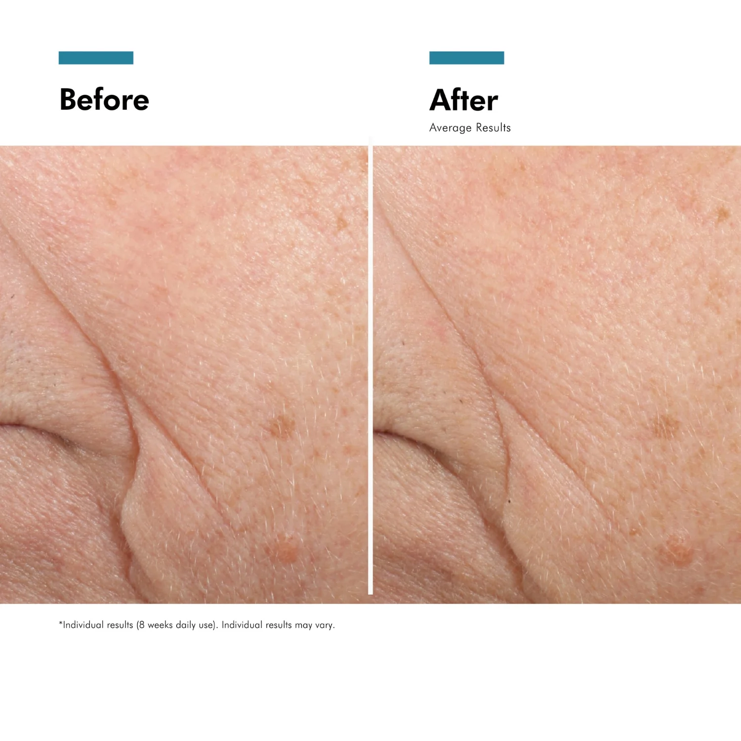 SkinCeuticals | Triple Lipid Restore 2:4:2 48ml - Image 3