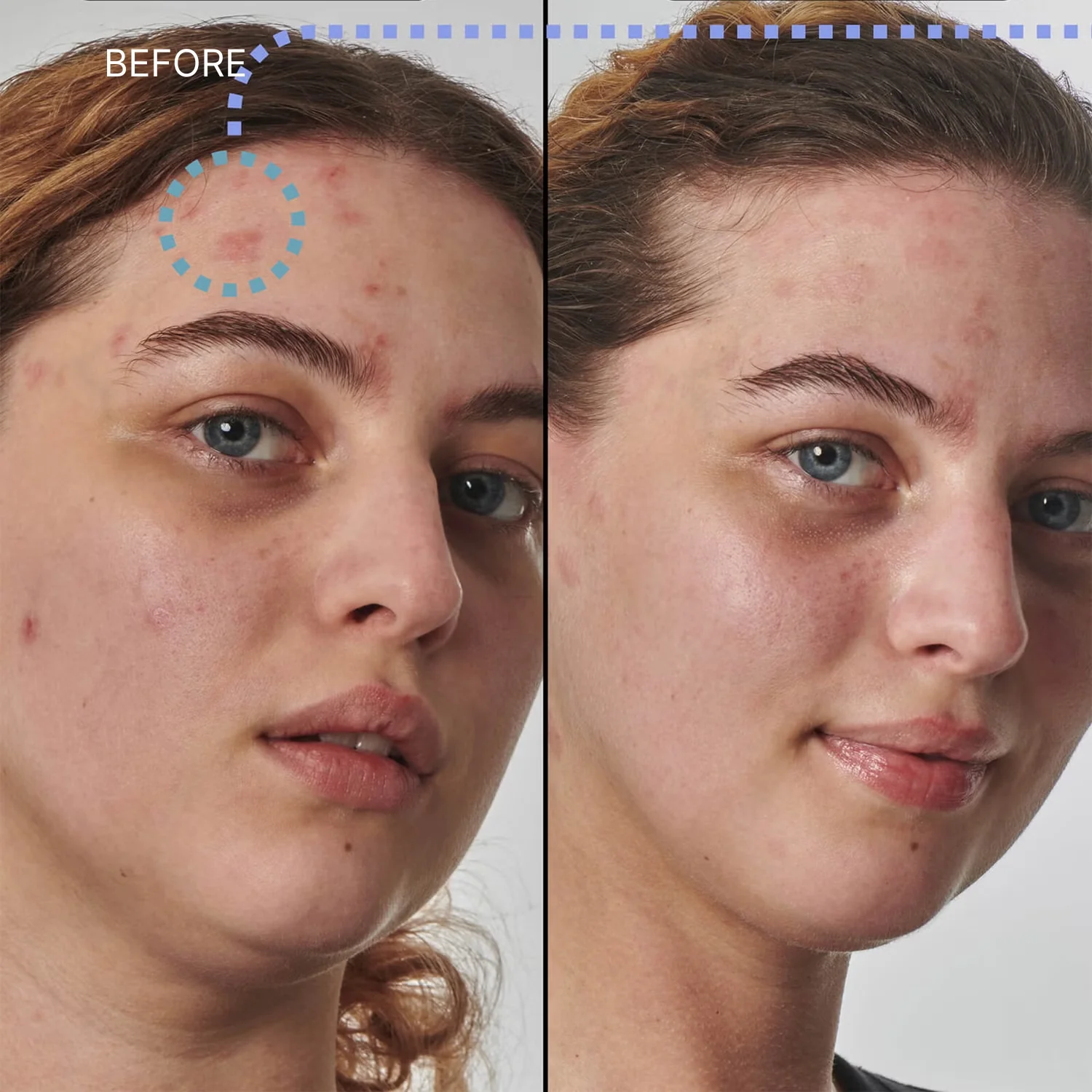 The Inkey List | Super Solutions 10% Urea Moisturizer 50ml - Image 3