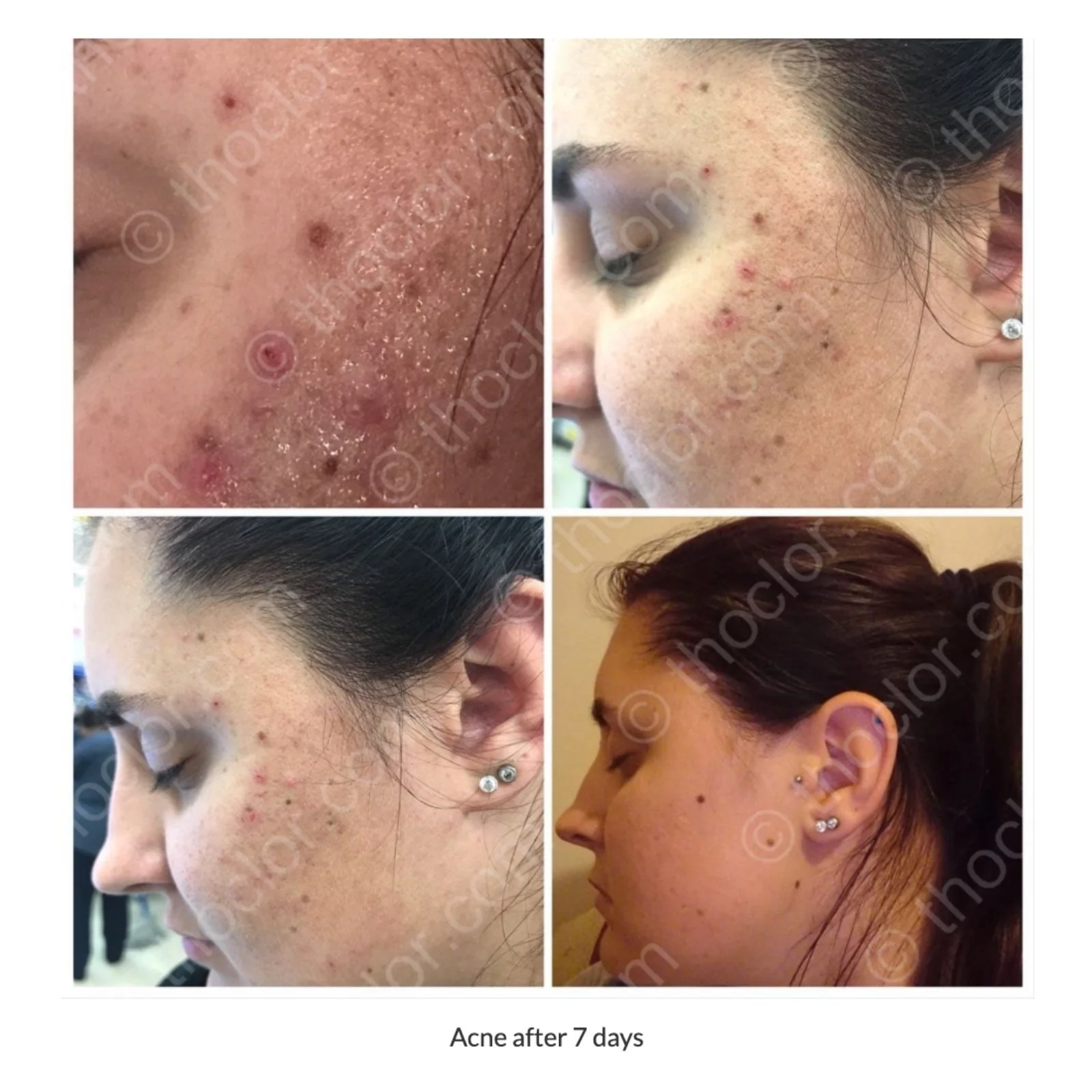 ThoClor Labs GF2 Skin Rejuvenation 100ml - Image 5